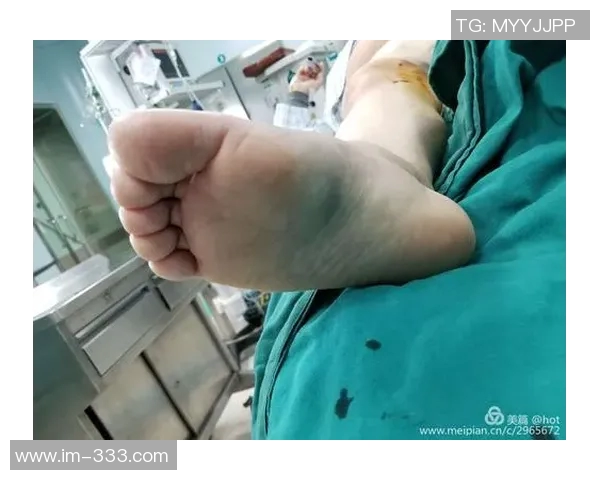 马德里竞技官方宣布朗格莱遭遇重度内侧副韧带扭伤无其他损伤